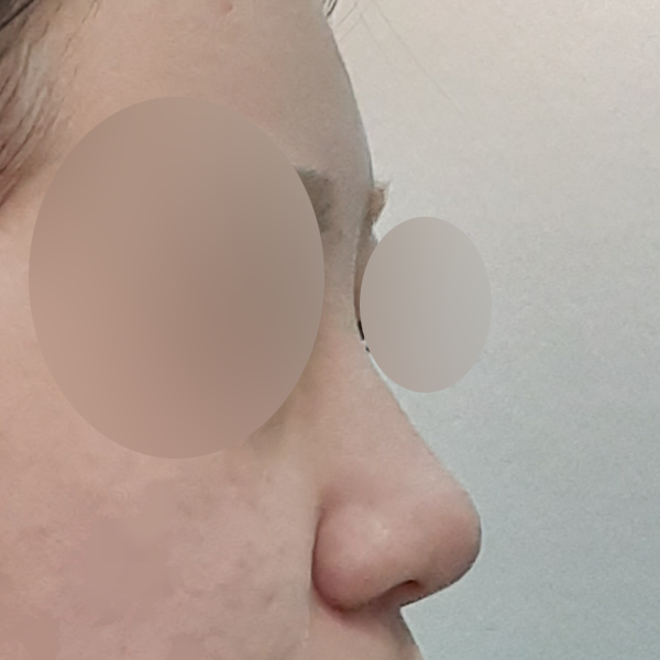 수술 전 후