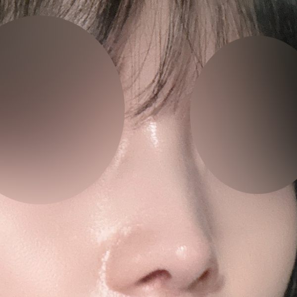 수술 전 후