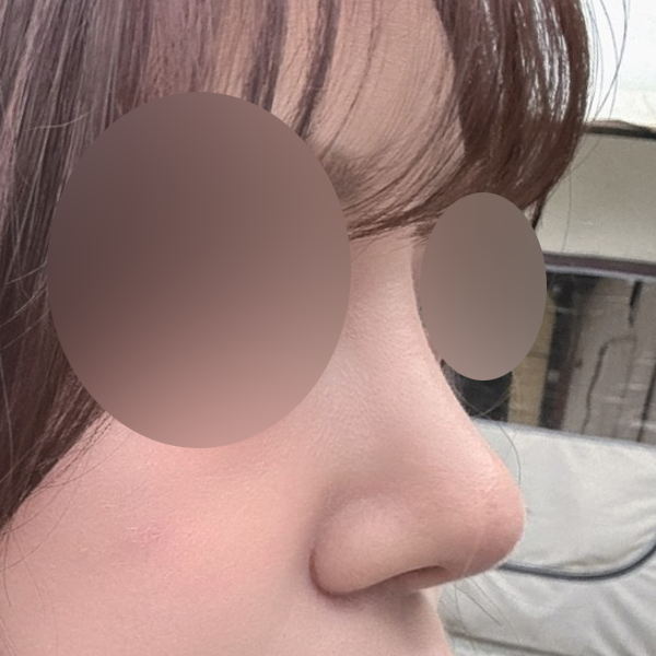 수술 전 후