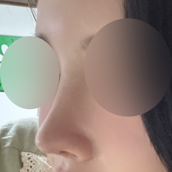 수술 전 후