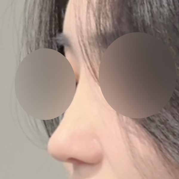 수술 전 후
