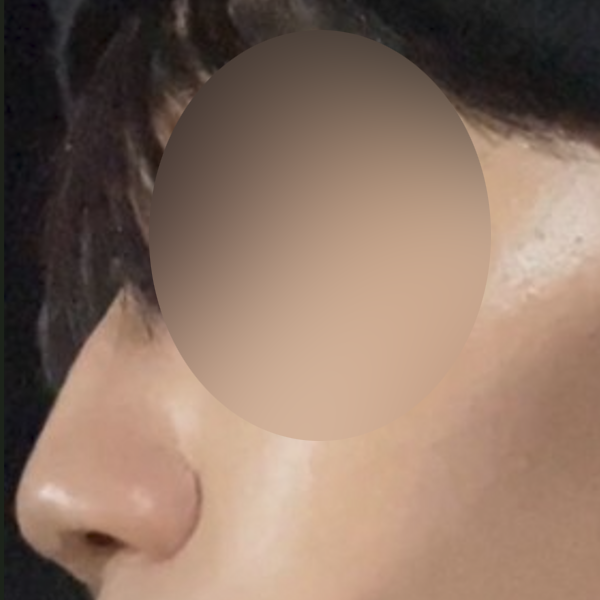 수술 전 후