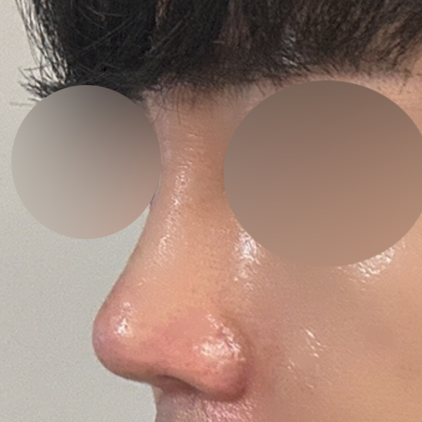 수술 전 후