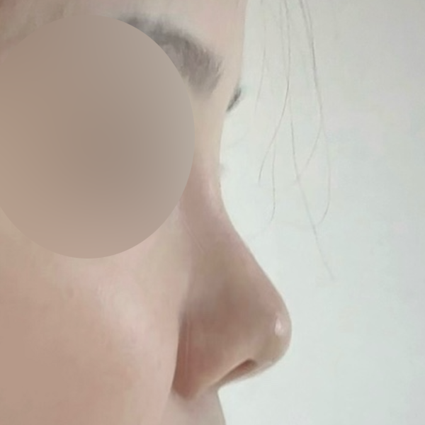수술 전 후