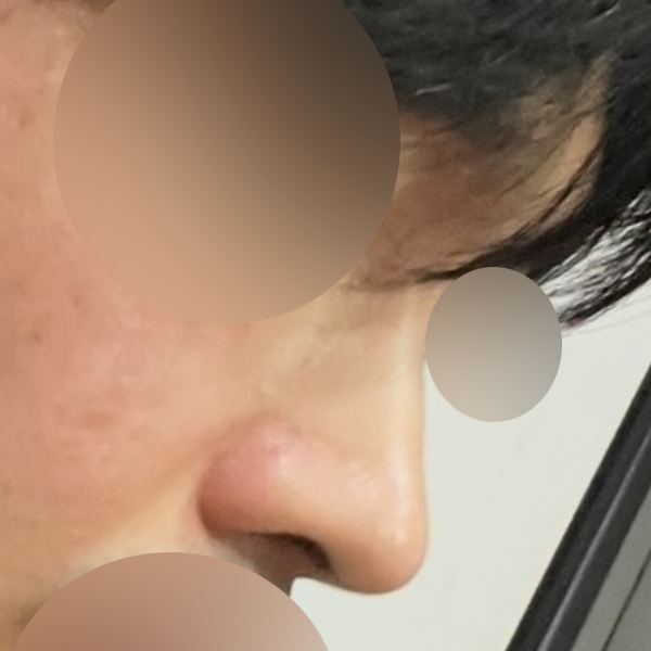 수술 전 후