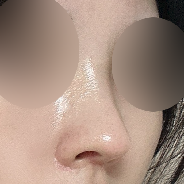수술 전 후